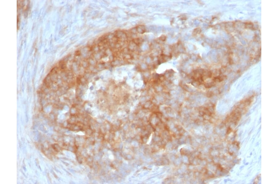 Immunohistochemistry - Anti-Fascin Antibody [FSCN1/417] - BSA and Azide free (A253171) - Antibodies.com