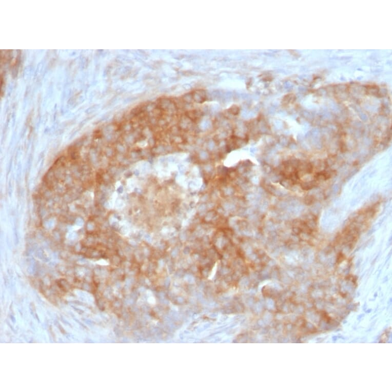 Immunohistochemistry - Anti-Fascin Antibody [FSCN1/417] - BSA and Azide free (A253171) - Antibodies.com