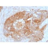 Immunohistochemistry - Anti-Fascin Antibody [FSCN1/417] - BSA and Azide free (A253171) - Antibodies.com