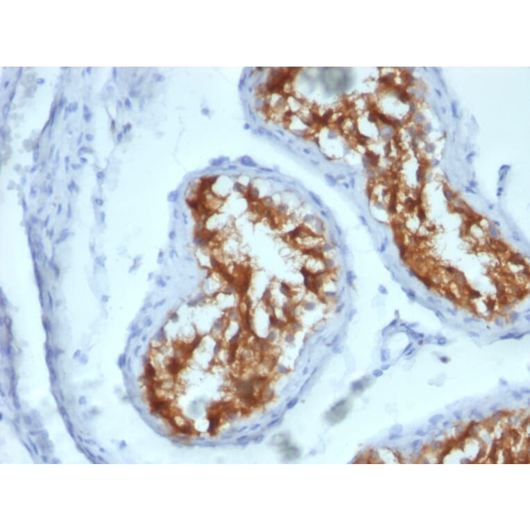 Immunohistochemistry - Anti-Fascin Antibody [FSCN1/417] - BSA and Azide free (A253171) - Antibodies.com