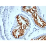 Immunohistochemistry - Anti-Fascin Antibody [FSCN1/417] - BSA and Azide free (A253171) - Antibodies.com