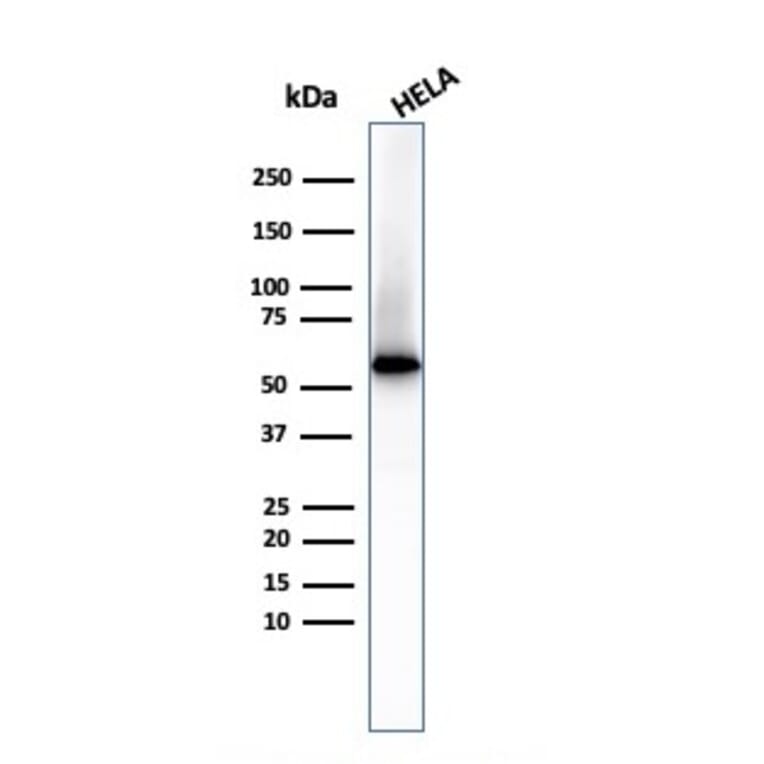 Western Blot - Anti-Fascin Antibody [FSCN1/417] - BSA and Azide free (A253171) - Antibodies.com