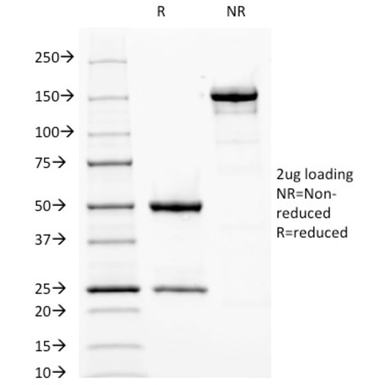 SDS-PAGE - Anti-Fascin Antibody [FSCN1/417] - BSA and Azide free (A253171) - Antibodies.com
