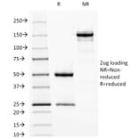 SDS-PAGE - Anti-Fascin Antibody [FSCN1/417] - BSA and Azide free (A253171) - Antibodies.com