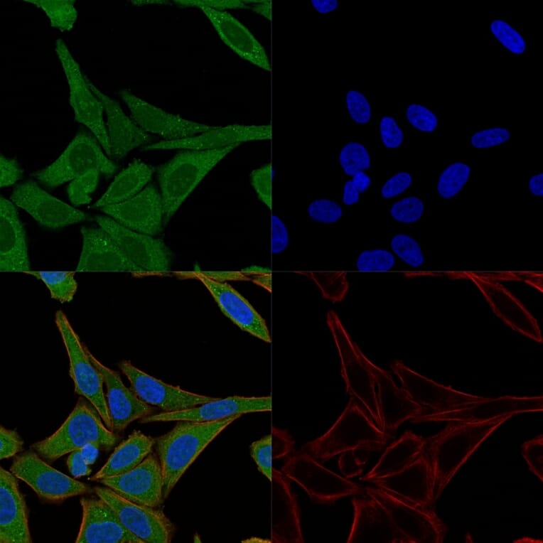 Immunofluorescence - Anti-Fascin Antibody [FSCN1/417] - BSA and Azide free (A253171) - Antibodies.com