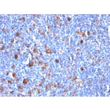 Immunohistochemistry - Anti-Fascin Antibody [SPM133] - BSA and Azide free (A253172) - Antibodies.com