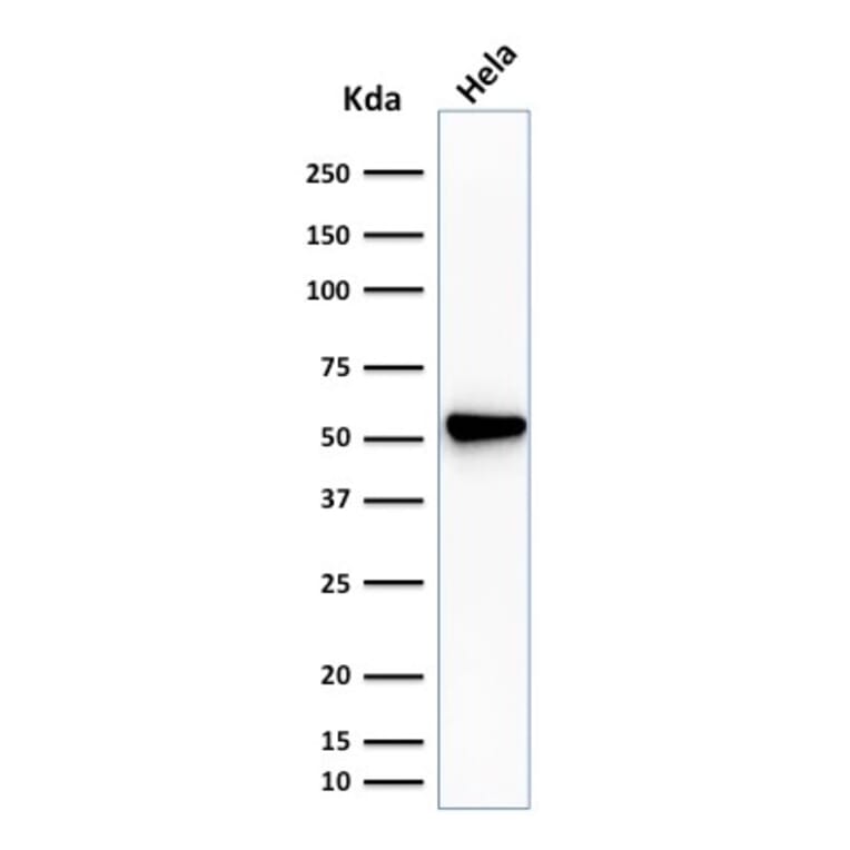 Western Blot - Anti-Fascin Antibody [SPM133] - BSA and Azide free (A253172) - Antibodies.com