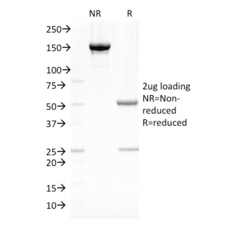 SDS-PAGE - Anti-Fascin Antibody [SPM133] - BSA and Azide free (A253172) - Antibodies.com