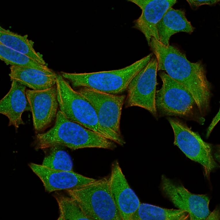 Immunofluorescence - Anti-Fascin Antibody [SPM133] - BSA and Azide free (A253172) - Antibodies.com