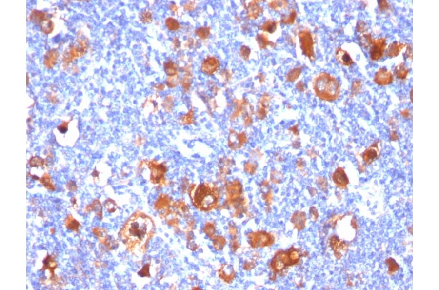 Immunohistochemistry - Anti-Fascin Antibody [FSCN1/418] - BSA and Azide free (A253173) - Antibodies.com