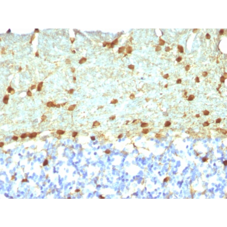 Immunohistochemistry - Anti-Fascin Antibody [FSCN1/418] - BSA and Azide free (A253173) - Antibodies.com