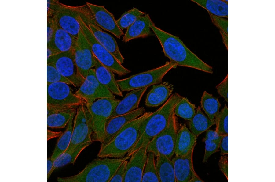 Immunofluorescence - Anti-Fascin Antibody [FSCN1/418] - BSA and Azide free (A253173) - Antibodies.com