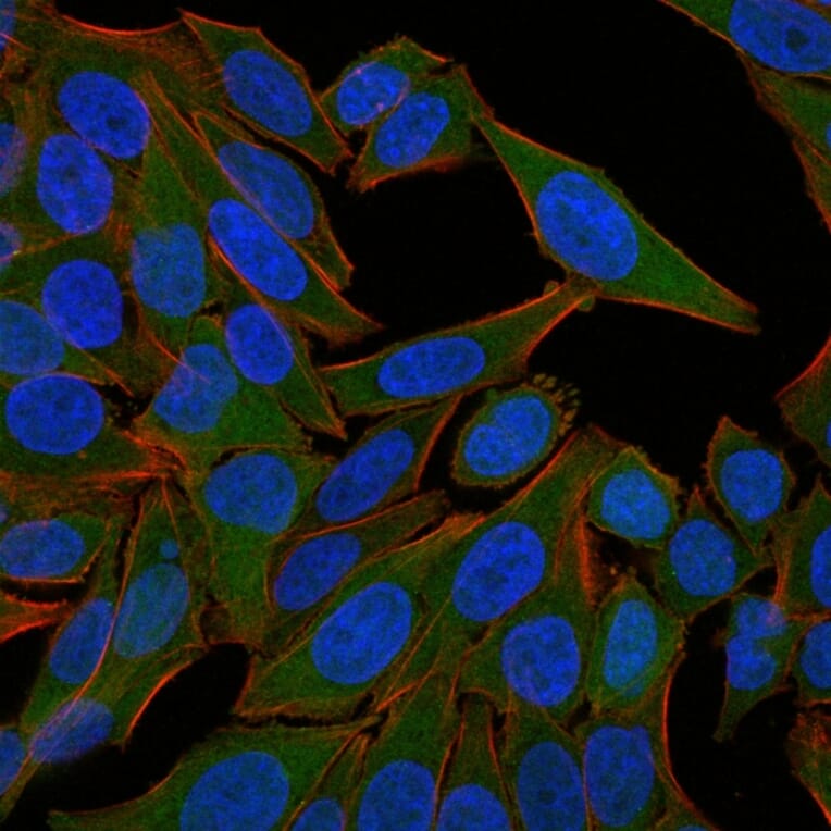 Immunofluorescence - Anti-Fascin Antibody [FSCN1/418] - BSA and Azide free (A253173) - Antibodies.com