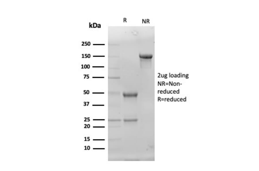 SDS-PAGE - Anti-Superoxide Dismutase 1 Antibody [SOD1/4330] - BSA and Azide free (A253174) - Antibodies.com