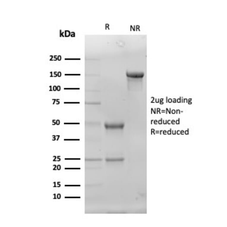 SDS-PAGE - Anti-Superoxide Dismutase 1 Antibody [SOD1/4330] - BSA and Azide free (A253174) - Antibodies.com