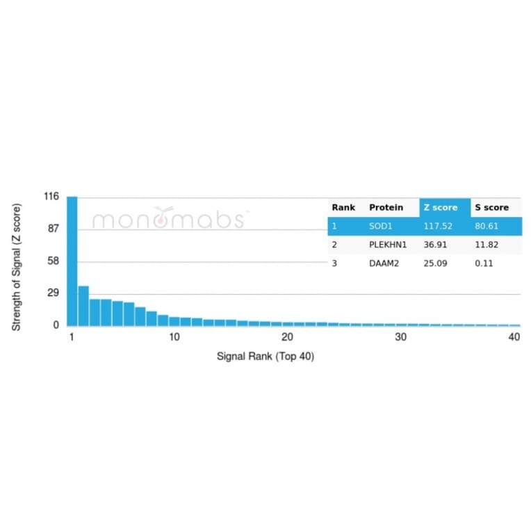 Protein Array - Anti-Superoxide Dismutase 1 Antibody [SOD1/4330] - BSA and Azide free (A253173) - Antibodies.com