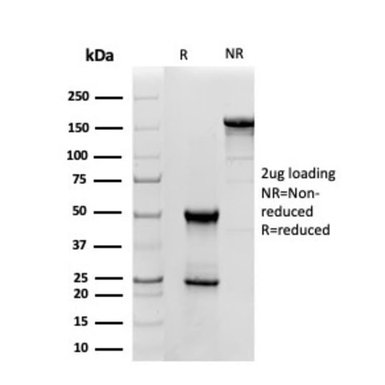 SDS-PAGE - Anti-Superoxide Dismutase 1 Antibody [SOD1/4331] - BSA and Azide free (A253175) - Antibodies.com