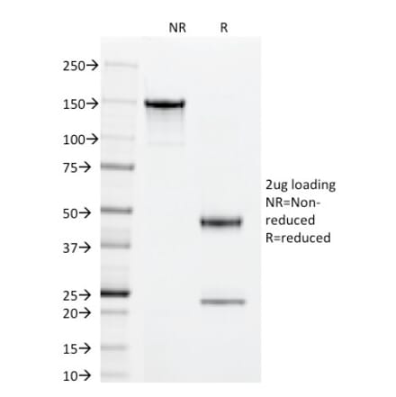 SDS-PAGE - Anti-Superoxide Dismutase 1 Antibody [SOD1/2089] - BSA and Azide free (A253176) - Antibodies.com