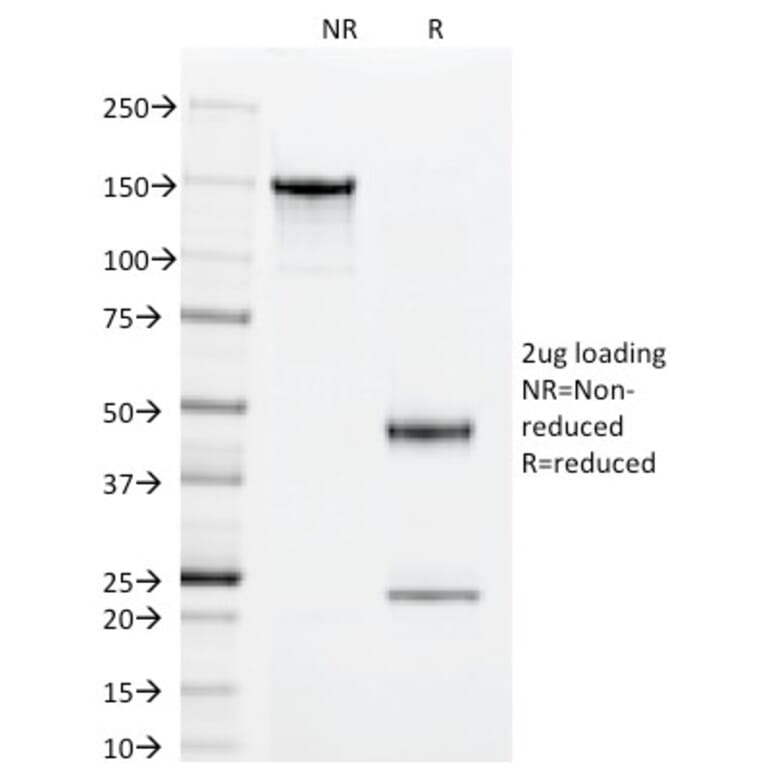 SDS-PAGE - Anti-Superoxide Dismutase 1 Antibody [SOD1/2089] - BSA and Azide free (A253176) - Antibodies.com