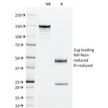 SDS-PAGE - Anti-Superoxide Dismutase 1 Antibody [SOD1/2089] - BSA and Azide free (A253176) - Antibodies.com