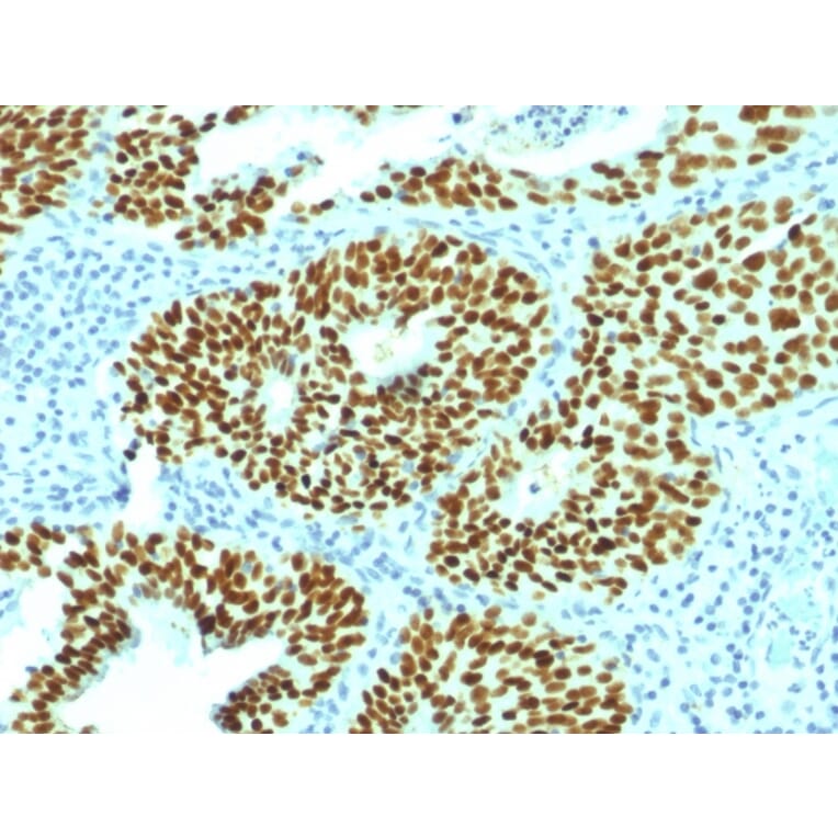 Immunohistochemistry - Anti-SOX2 Antibody [SOX2/1792] - BSA and Azide free (A253183) - Antibodies.com