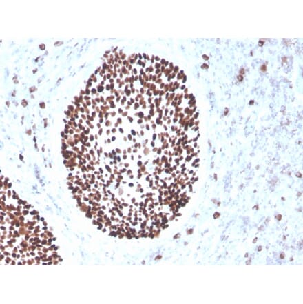 Immunohistochemistry - Anti-SOX2 Antibody [rSOX2/1791] - BSA and Azide free (A253183) - Antibodies.com