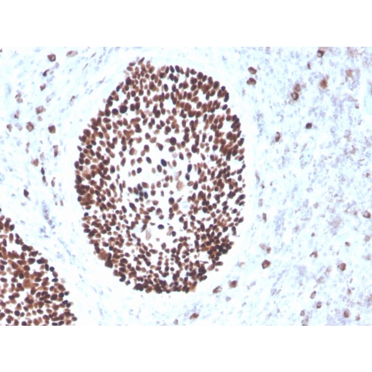 Immunohistochemistry - Anti-SOX2 Antibody [rSOX2/1791] - BSA and Azide free (A253183) - Antibodies.com