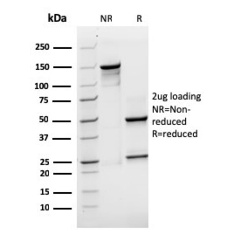 SDS-PAGE - Anti-SOX2 Antibody [rSOX2/1791] - BSA and Azide free (A253184) - Antibodies.com