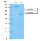 SDS-PAGE - Anti-SOX2 Antibody [SOX2/3169R] - BSA and Azide free (A253186) - Antibodies.com