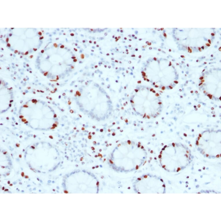 Immunohistochemistry - Anti-SOX4 Antibody [SOX4/2540] - BSA and Azide free (A253188) - Antibodies.com