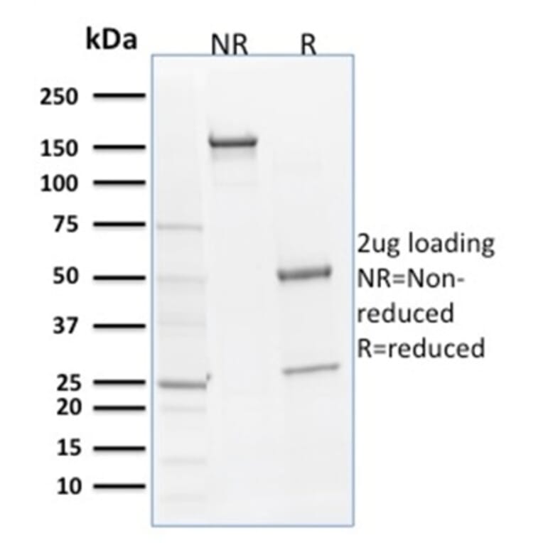 SDS-PAGE - Anti-SOX9 Antibody [SOX9/2398] - BSA and Azide free (A253189) - Antibodies.com