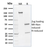 SDS-PAGE - Anti-SOX9 Antibody [SOX9/2398] - BSA and Azide free (A253189) - Antibodies.com
