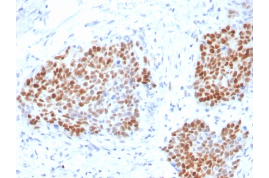 Immunohistochemistry - Anti-SOX9 Antibody [SOX9/3916R] - BSA and Azide free (A253189) - Antibodies.com
