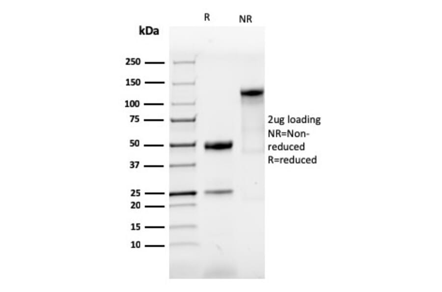 SDS-PAGE - Anti-SOX9 Antibody [SOX9/3916R] - BSA and Azide free (A253190) - Antibodies.com