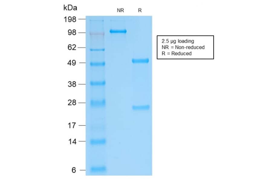 SDS-PAGE - Anti-SOX9 Antibody [SOX9/2287R] - BSA and Azide free (A253190) - Antibodies.com