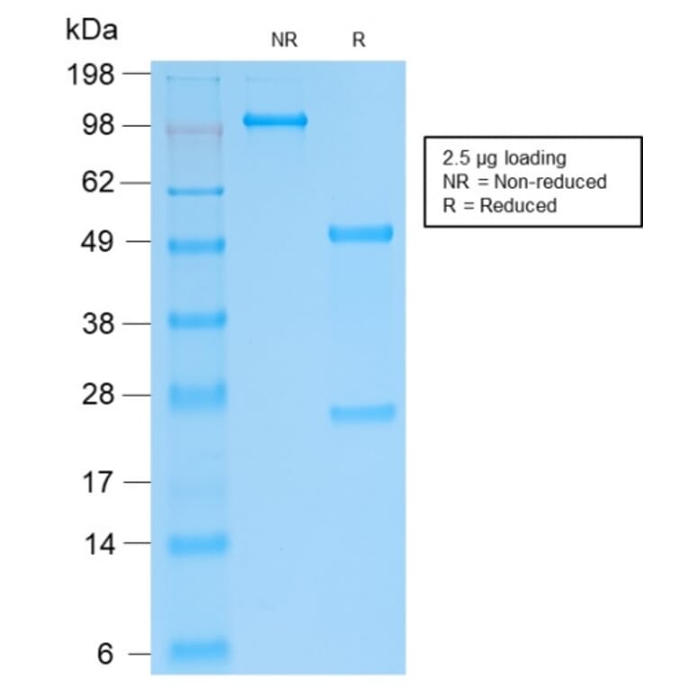 SDS-PAGE - Anti-SOX9 Antibody [SOX9/2287R] - BSA and Azide free (A253190) - Antibodies.com