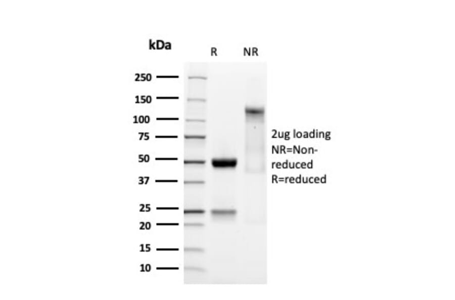 SDS-PAGE - Anti-SOX9 Antibody [SOX9/3141R] - BSA and Azide free (A253192) - Antibodies.com