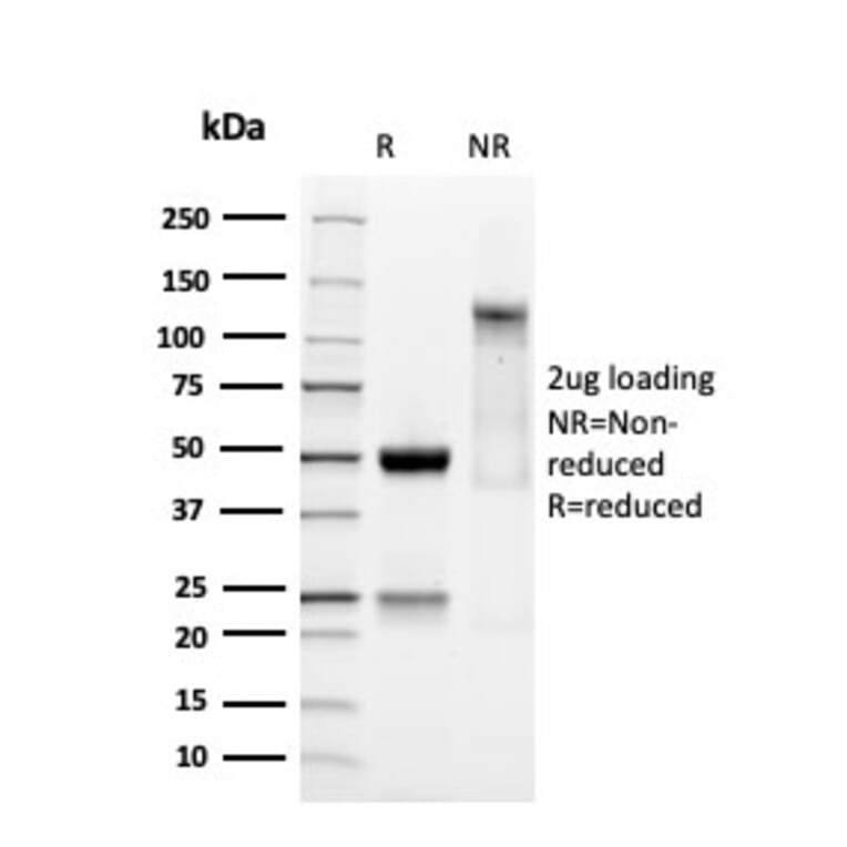 SDS-PAGE - Anti-SOX9 Antibody [SOX9/3141R] - BSA and Azide free (A253192) - Antibodies.com