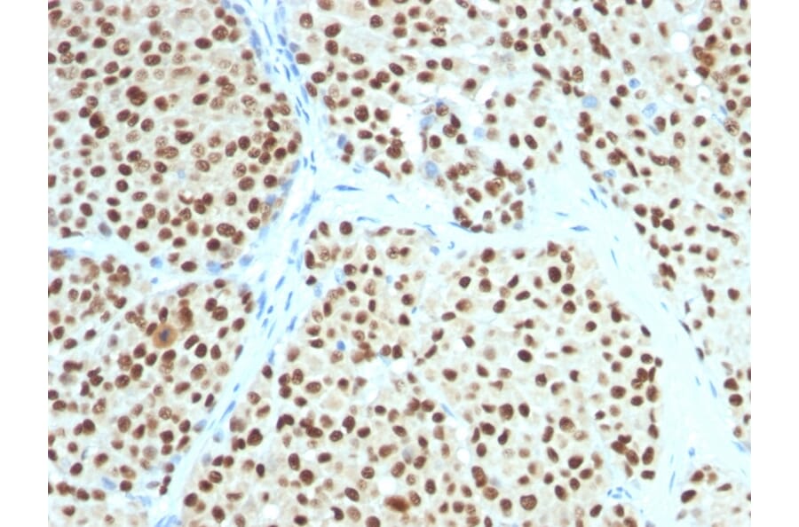 Immunohistochemistry - Anti-SOX10 Antibody [SOX10/991] - BSA and Azide free (A253193) - Antibodies.com