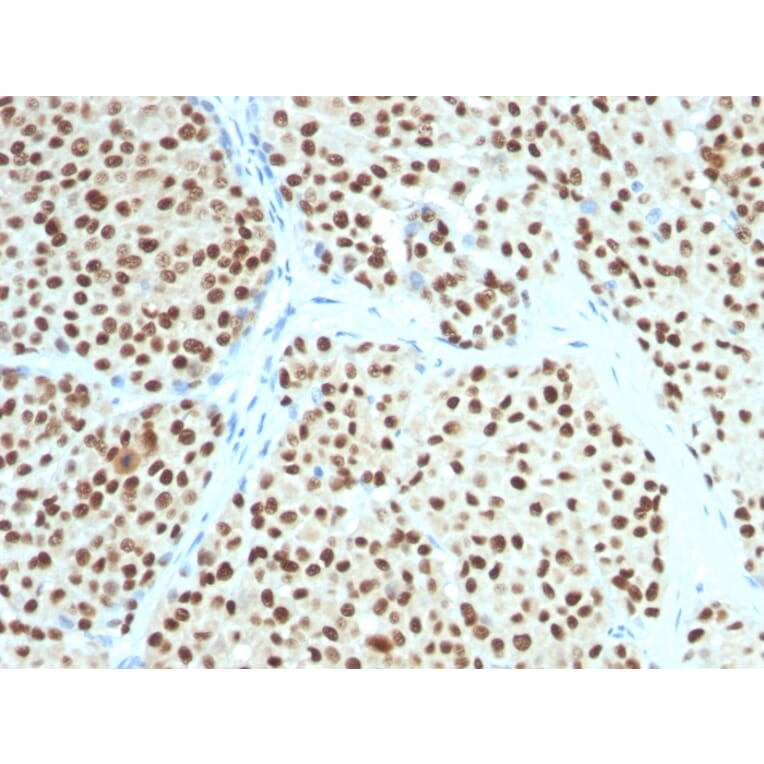 Immunohistochemistry - Anti-SOX10 Antibody [SOX10/991] - BSA and Azide free (A253193) - Antibodies.com