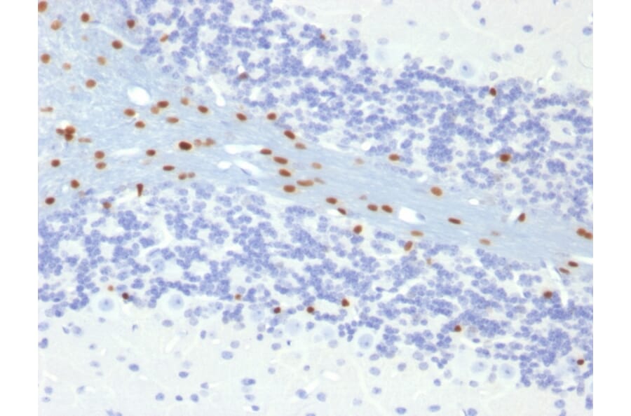 Immunohistochemistry - Anti-SOX10 Antibody [SOX10/991] - BSA and Azide free (A253193) - Antibodies.com