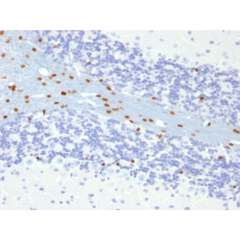 Immunohistochemistry - Anti-SOX10 Antibody [SOX10/991] - BSA and Azide free (A253193) - Antibodies.com