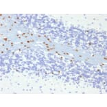 Immunohistochemistry - Anti-SOX10 Antibody [SOX10/991] - BSA and Azide free (A253193) - Antibodies.com