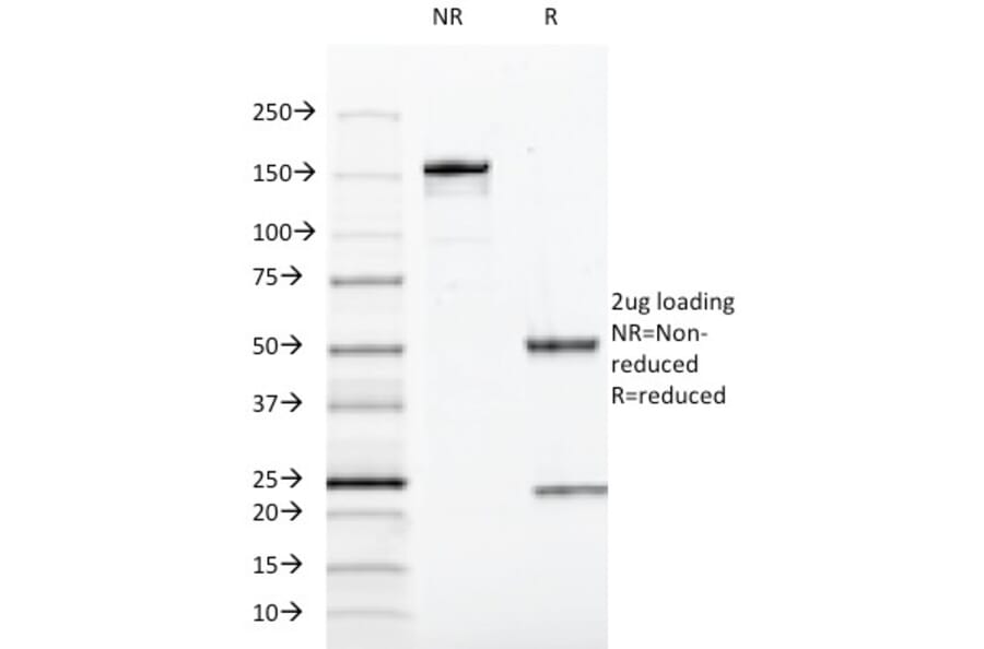 SDS-PAGE - Anti-SOX10 Antibody [SOX10/991] - BSA and Azide free (A253193) - Antibodies.com