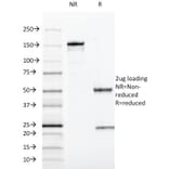 SDS-PAGE - Anti-SOX10 Antibody [SOX10/991] - BSA and Azide free (A253193) - Antibodies.com
