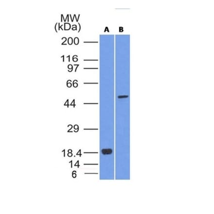 Western Blot - Anti-SOX10 Antibody [SOX10/992] - BSA and Azide free (A253194) - Antibodies.com