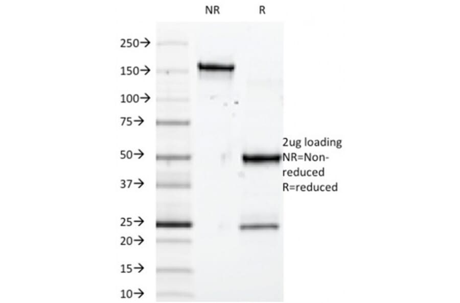 SDS-PAGE - Anti-SOX10 Antibody [SOX10/992] - BSA and Azide free (A253194) - Antibodies.com