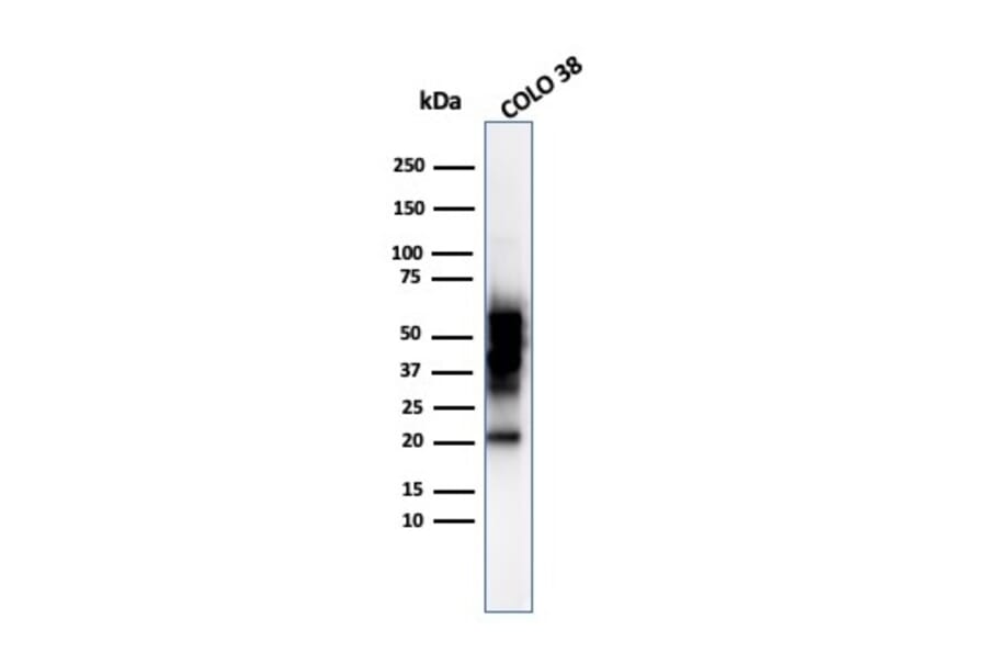 Western Blot - Anti-SOX10 Antibody [SOX10/992] - BSA and Azide free (A253194) - Antibodies.com