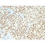 Immunohistochemistry - Anti-SOX10 Antibody [SOX10/1074] - BSA and Azide free (A253195) - Antibodies.com