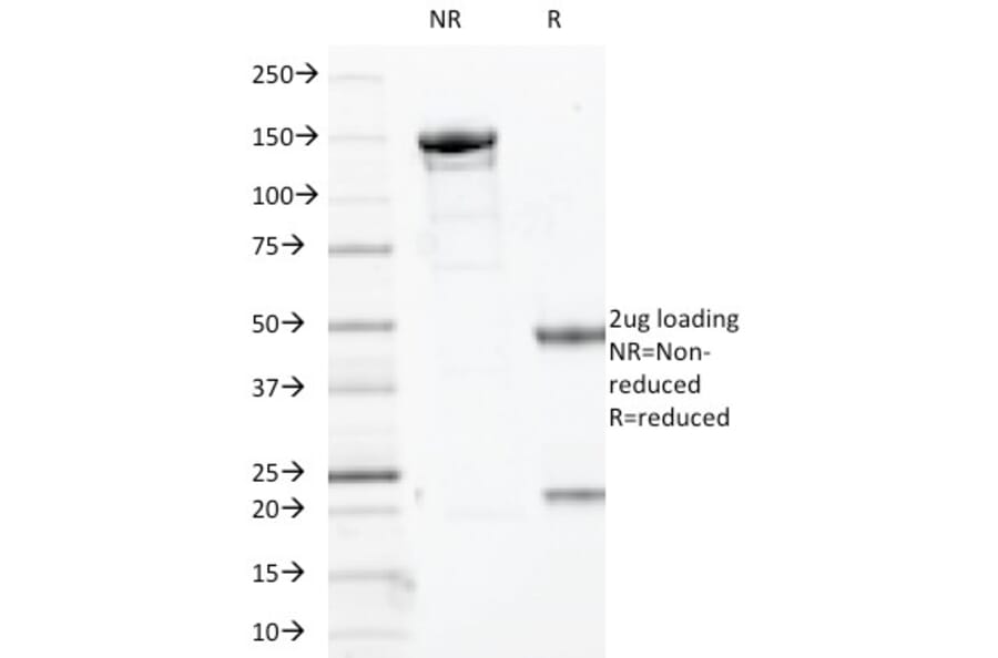 SDS-PAGE - Anti-SOX10 Antibody [SOX10/1074] - BSA and Azide free (A253195) - Antibodies.com